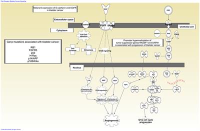 New Roadmaps for Non-muscle-invasive Bladder Cancer With Unfavorable Prognosis